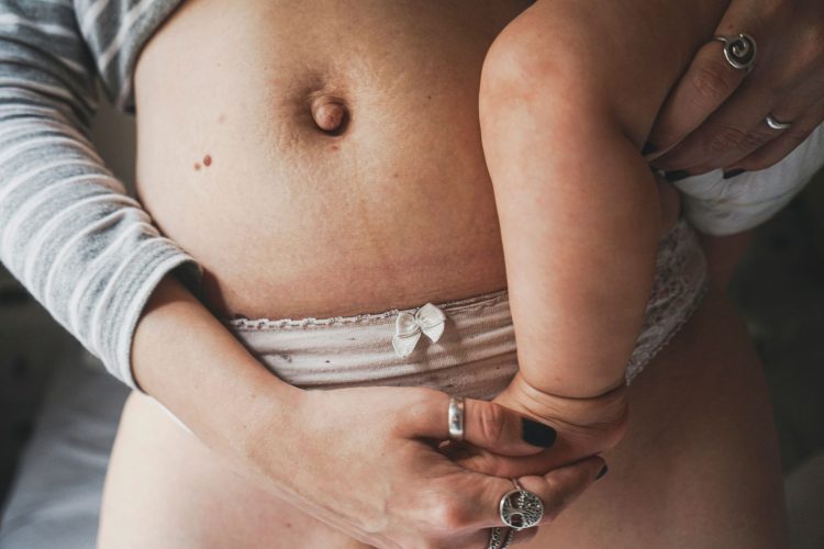 barriga postparto