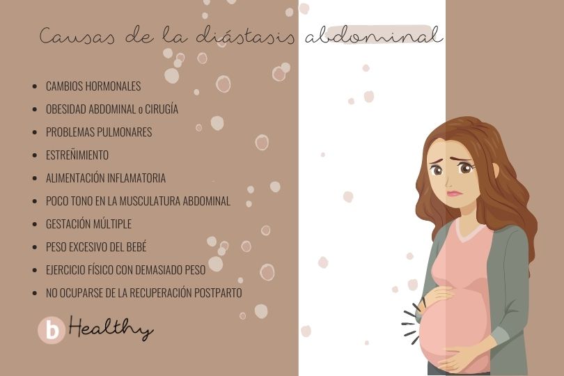 causas de la diástasis abdominal en el embarazo