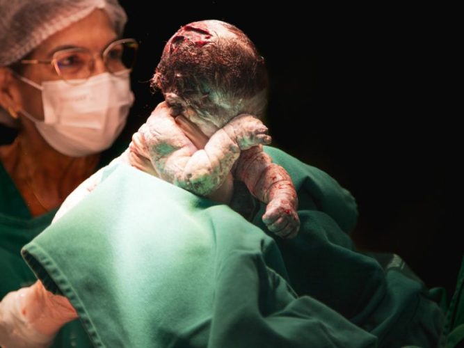 recuperación de una episiotomía